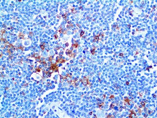 IHC of CD25 Mmab on an FFPE Tonsil Tissue